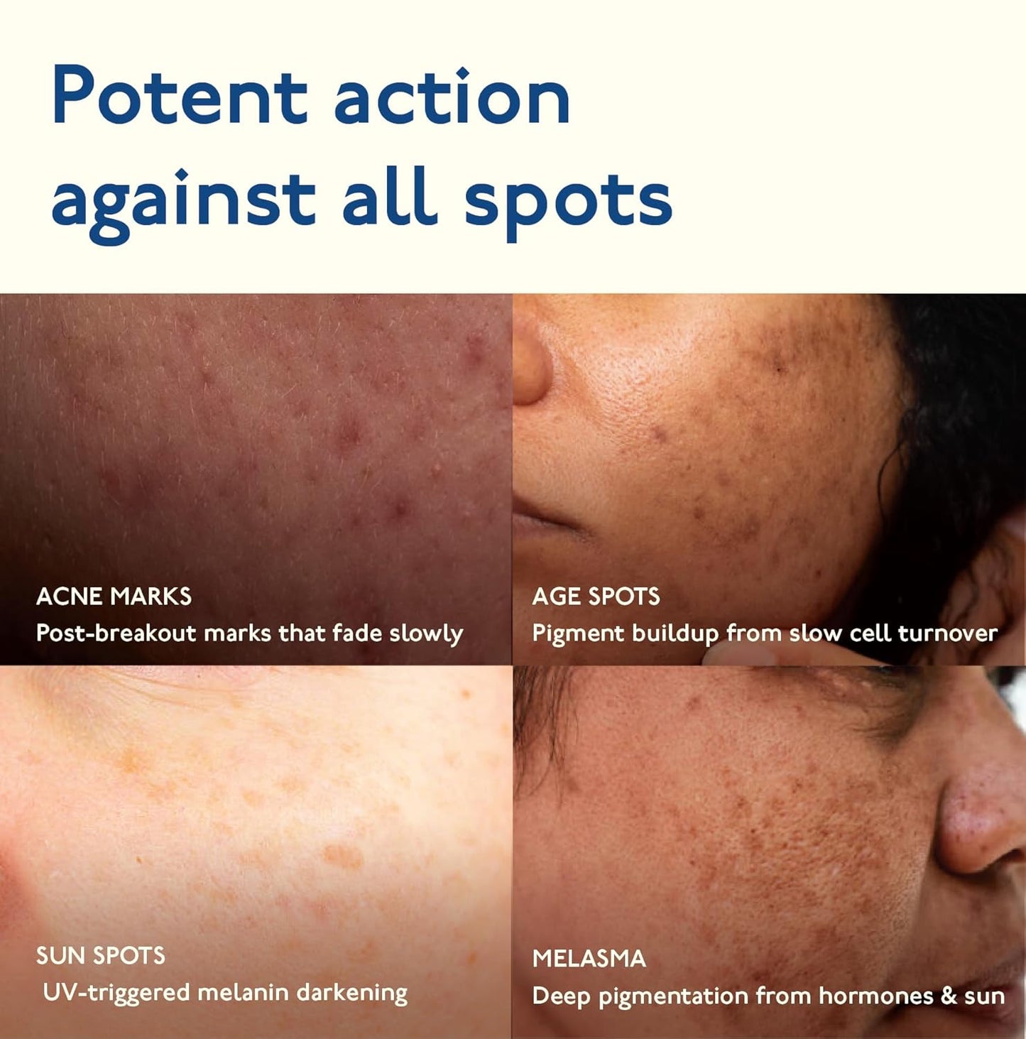 Asaya Advanced Dark Spot Targeting Gel 15 g