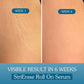 Bake StriErase Stretch Marks Removal Roll On Serum, 50 ml